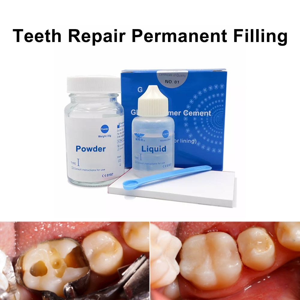 Teeth Whitening Kit At Home - Kit Perbaikan Tambal Gigi Permanen Di