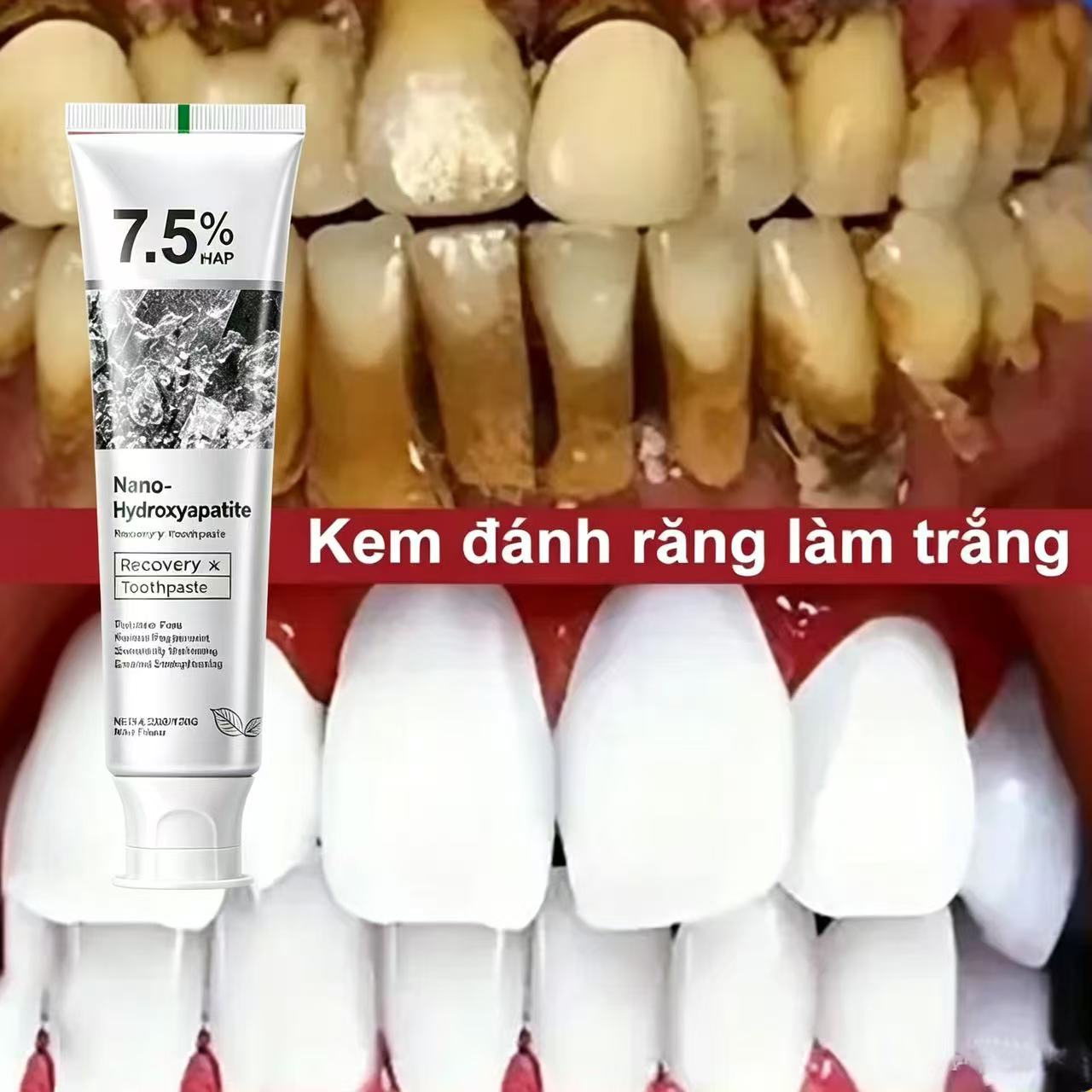 Hydroxyapatite Toothpaste - Pasta Gigi Pemutih Probiotik 7.5% Hidroksiapatit