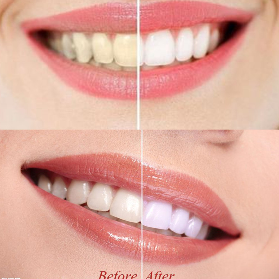 Arang Bambu Gigi Gigi Gigi Gig - Teeth Whitening Co ulasan dan harga