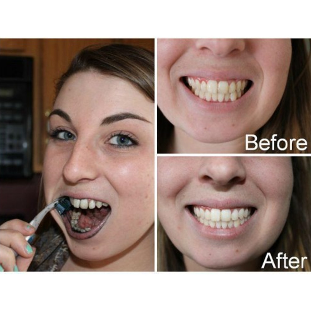 Arang Bambu Gigi Gigi Gigi Gig - Teeth Whitening Co ulasan dan harga