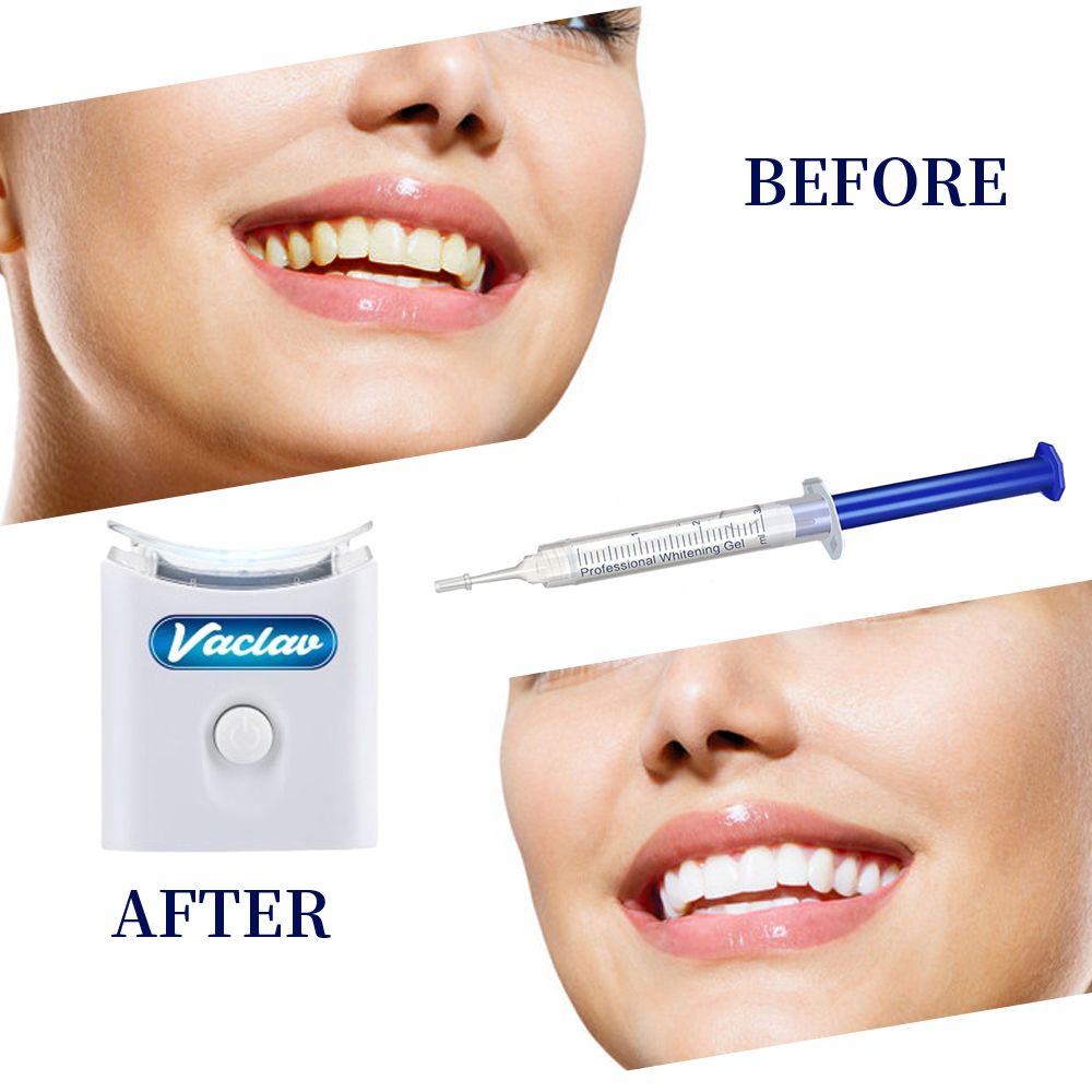 Kit Pemutih Gigi di Rumah deng - Teeth Whitening Kit At Home ulasan dan harga