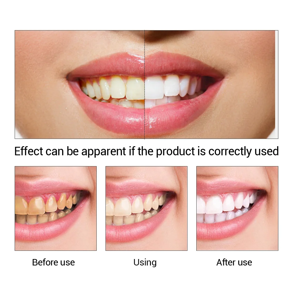 FTEENPLY Bubuk Esensi Pemutih  - Teeth Whitening Powder ulasan dan harga