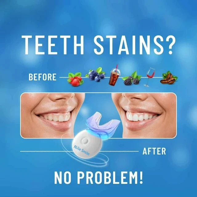 Perangkat Pemutih Gigi Nirkabe - Teeth Whitening Kit At Home ulasan dan harga
