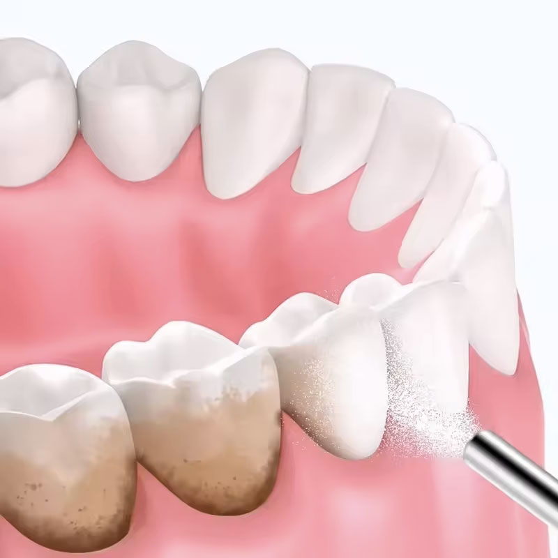 130g Bubuk Sandblasting Gigi B - Teeth Whitening Co ulasan dan harga