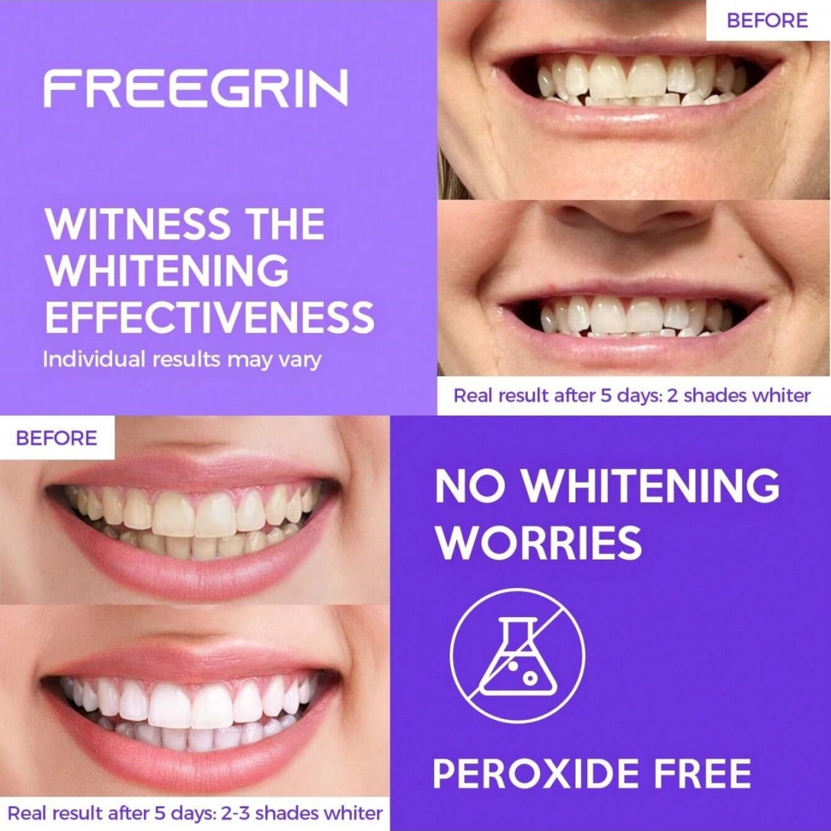 Stiker Gigi Pemutih Mewah 7/14 - Teeth Whitening Foam ulasan dan harga
