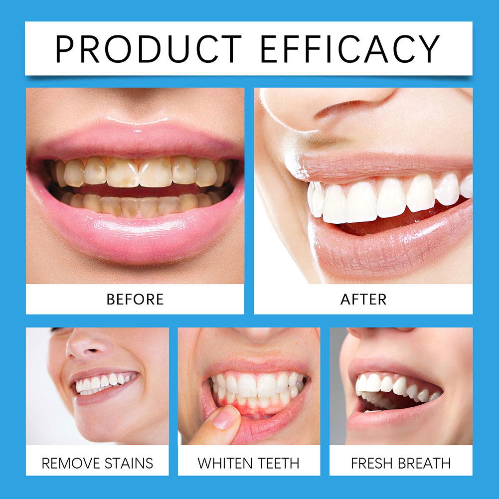 Bubuk Penghilang Noda Gigi Pro - Teeth Whitening For Photos ulasan dan harga